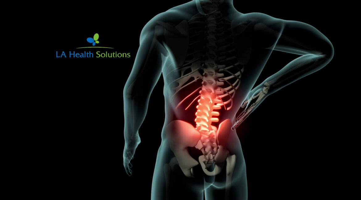 Effective Back Pain Treatment at LA Health Solutions