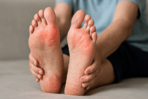 Early Neuropathy Symptoms: Don’t Wait to Get Help
