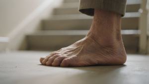 Neuropathy Numbness and Tingling